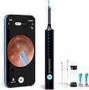 Smartbud™ Ear Wax Removal Tool with Camera - 1920P Smart Ear Cleaner Earwax Removal Kit - Otoscope with Light (6 LED Lights) Best Ear Camera Ear Scope Endoscope Ear Cleaning Kit Ear Cleaning Camera