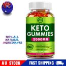 Keto Gummies Ketone Advanced Weight Loss Fat Burner Men Women Dietary Supplement