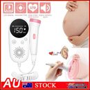 Fetal Doppler Pocket Baby Heart Monitor Fetal Heartbeat Doppler for Pregnancy AU