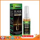 20ml Hair Growth Spray Men Women Ginger Hair Growth Essence Hair Care Products