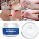 Urea Cream 42% Plus Salicylic Acid 4 Oz Upgraded Callus Remover Hand Cream Foot Cream for Dry