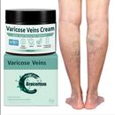 Mejores cremas recomendadas para mejorar la circulacion de las piernas