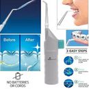 Dental Oral Care Water Jet Oral Irrigator Flosser Tooth SPA Teeth Pick Cleaner