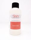 4 oz Acne Stop ~Skin Obsession~ Excellent Acne & Blemish Skin Care Product!!
