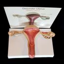 Anatomical Healthy Human Uterus and Ovary Model - Female Medical Anatomy 