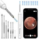 VITCOCO Ear Wax Removal Kit Ear Camera 1920P HD Ear Wax Removal Tool Ear Cleaner Otoscope with 6 LED Lights, 3mm Visual Ear Scope for iPhone iPad Android(White)