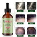 Mielle Rosemary 59ML Mint Scalp Hair Strengthening Oil For Woman Man Hair Growth