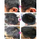 Productos de suero en aerosol de reparación para el crecimiento del cabello negro para el tratamiento de la pérdida del cabello ML30