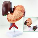 1:1 Pancreas spleen gallbladder inferior vena cava abdominal aorta stomach model