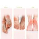 EXFOLIATING FOOT MASK Peel Off Remove Hard Dead Skin Callus Sock Baby Soft Feet