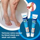 Fast Action Varicose Vein Cream Pain Relief Spider Vein Treatment Balm Leg Care