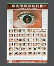 Tabla de diagnóstico ocular de TCM