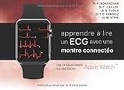 Apprendre à lire un ECG avec une montre connectée: cas cliniques basés sur des tracés Apple Watch