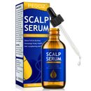 Scalp Serum Hair Growth Dandruff Relief Stop Hair Loss Treatment Regrowth Oil