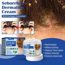 Hot Seborrheic Dermatitis Cream Scalp Treatment For Psoriasis Eczema Moisturize