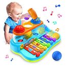 Baby Toys for 1 Year Old Boys Girls Baby Toys 12 Months Gifts for 2 Year Old Boy