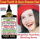 Extra Strength Super Potent Gum Disease Cure Stop Bleeding Receding Gums - 100ML