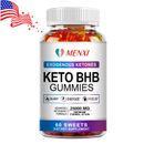 Keto Acv Gummies - Weight Loss, Appetite Suppressant, Liver Detox - Fat Burner