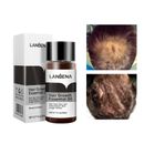 1 pz prodotti essenza per la crescita dei capelli veloce e potente olio essenziale trattamento per la perdita dei capelli